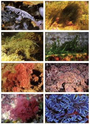  Zoothamnium: Un predatore microscopico che si aggrappa alle alghe come una ballerina di corda!