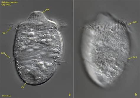 Didinium: This Mighty Micro-Hunter Boasts an Enormous Oral Apparatus for Consuming Its Ciliate Prey!