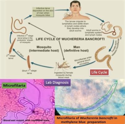  Filariosi! Un Parassita Subdolo che Mette alla Prova il Sistema Immunitario del suo Ospite