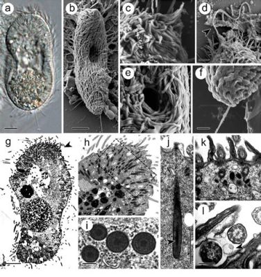  Ichthyophthirius multifiliis: Un parassita invisibile che causa pandemonio nelle piscine!